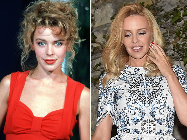 Kylie Minogue