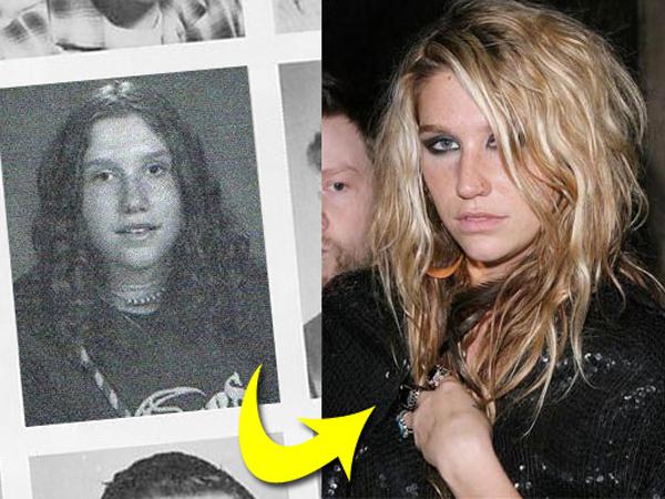 Ke$ha