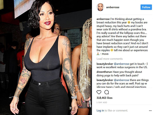 Amber Rose : "Ma poitrine est trop lourde"