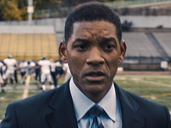 Concussion