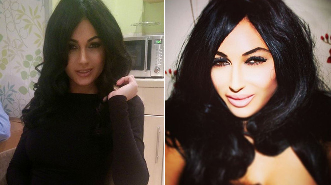 22.000 euros pour ressembler à Kim Kardashian