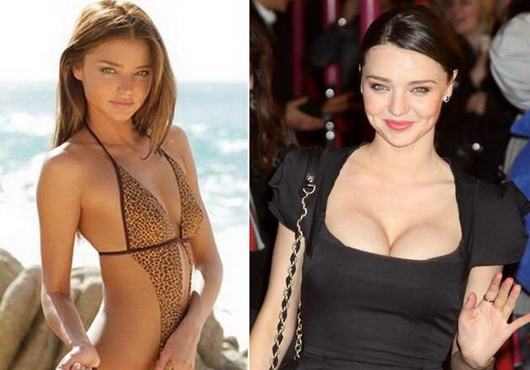 Nouvelle poitrine pour Miranda Kerr ?